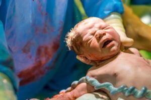 New Hampshire Birth Asphyxia Attorney